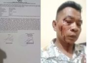 Bapak dan Anak Berprofesi Seorang Guru Ngaji Keroyok Wartawan Hingga Terluka