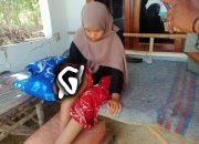 Divonis Kanker Ganas, Kaki Seorang Mahasiswa IAIN Pamekasan Terancam Di Amputasi