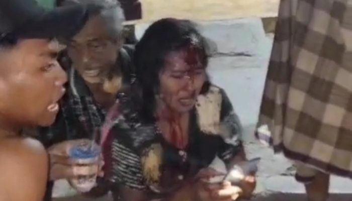 Bermodus Matikan Listrik, Pelaku KDRT di Pademawu Hantam Korban Dengan Kayu Jati
