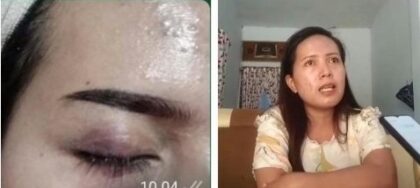 FOTO: Dokumentasi kondisi korban setelah dugaan penganiayaan.