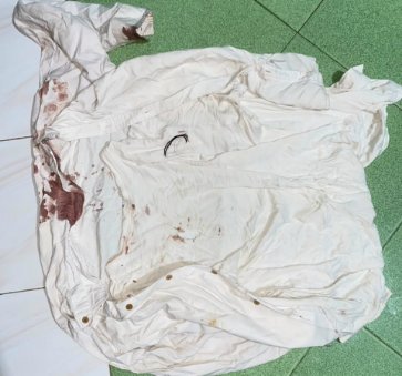 FOTO: Baju yang digunakan oleh korban usai kejadian terdapat banyak bercak darah.